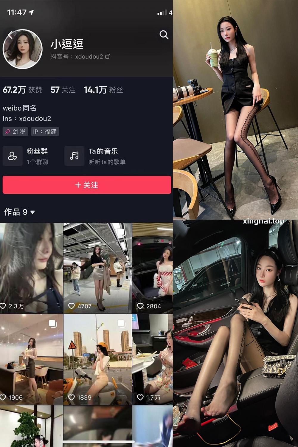 抖音 小逗逗 微密圈  NO.022期 【14P】