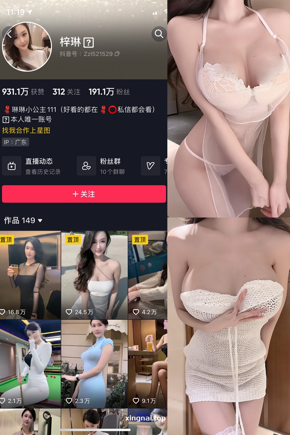 抖音 琳琳小公主 微密圈 002 期 【31P1V】