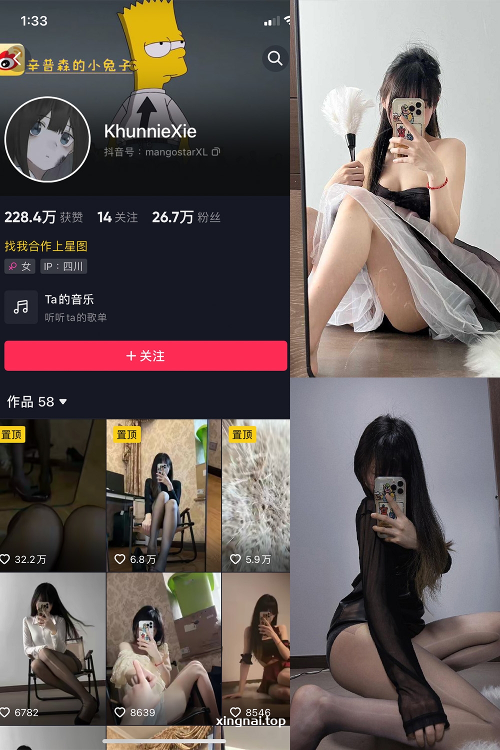 抖音 辛普森的兔子 微密圈  NO.002期 【34P8V】