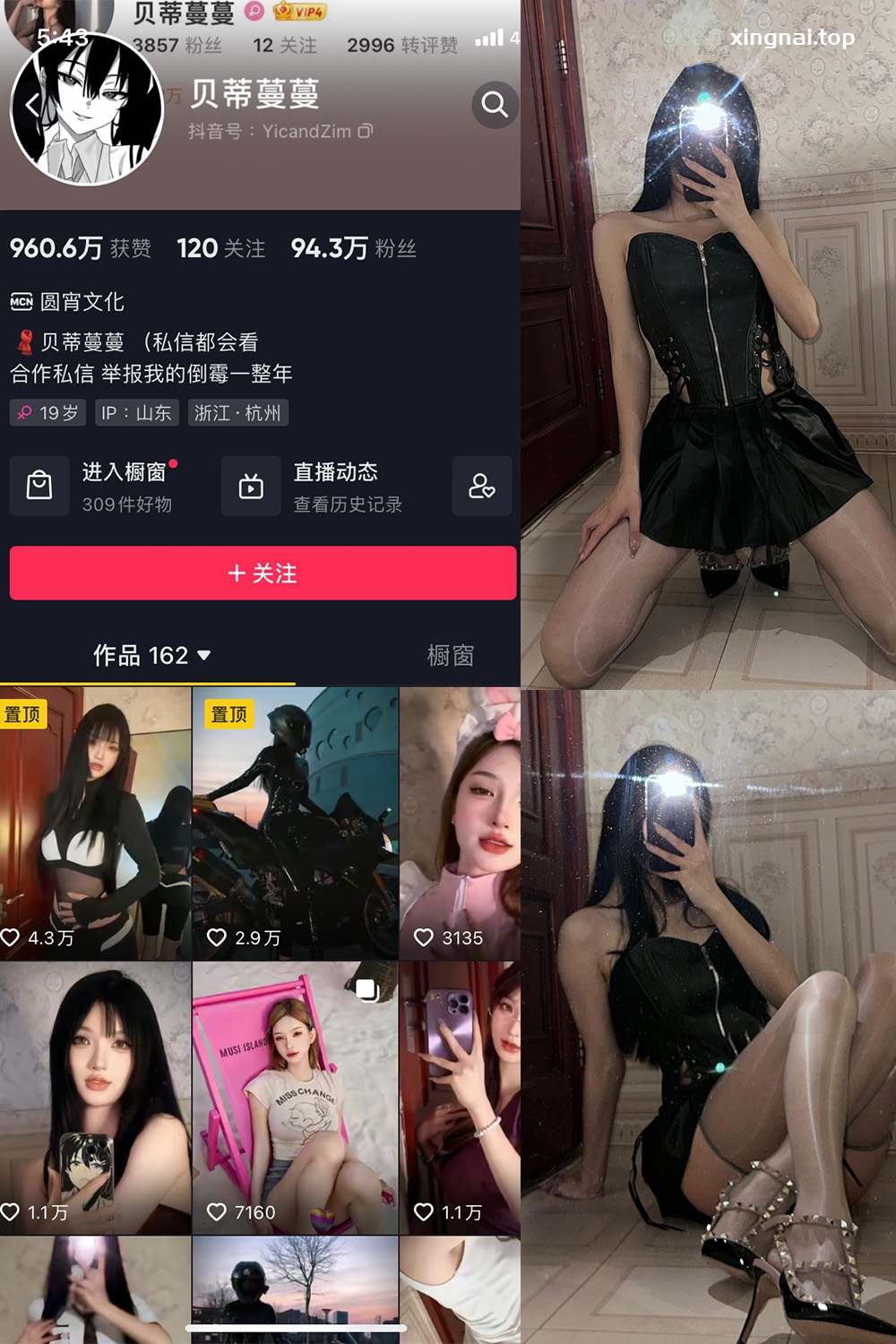 抖音贝蒂蔓蔓 微密圈 NO.001期 【45P10V】