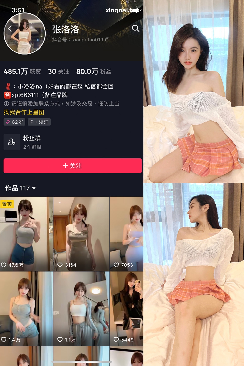 抖音 张洛洛 微密圈 NO.001期 【30P】