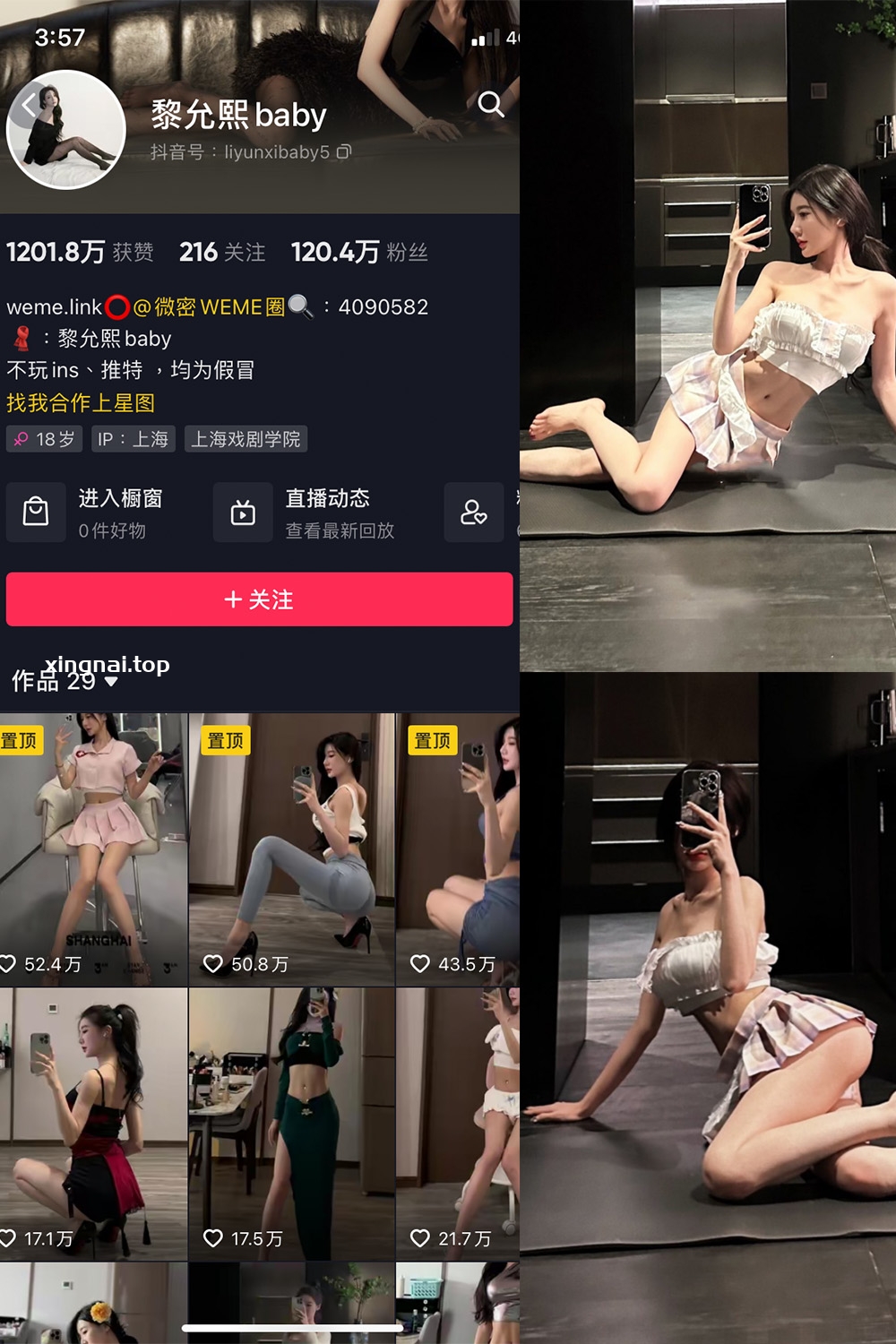 抖音 黎允熙baby 微密圈  NO.008期 【25P】