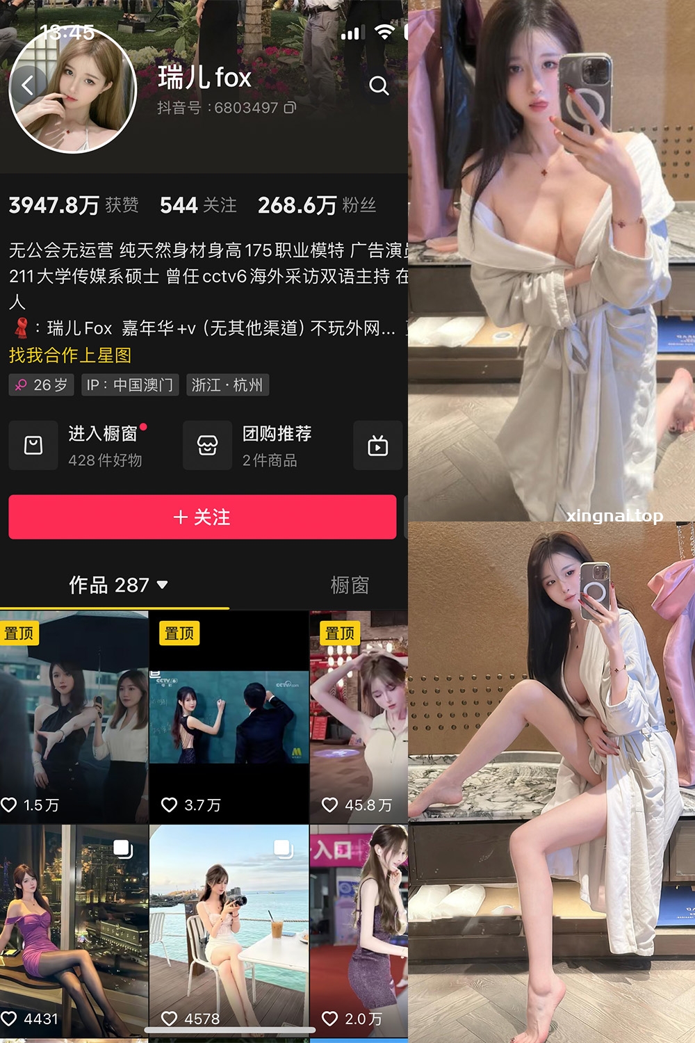 抖音 瑞儿fox 微密圈  NO.007期 【25P】最新至：2024.9.13