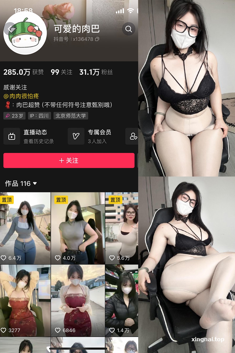 抖音 可爱的肉巴 微密圈 NO.022期 【25V】最新至:2024.4.25