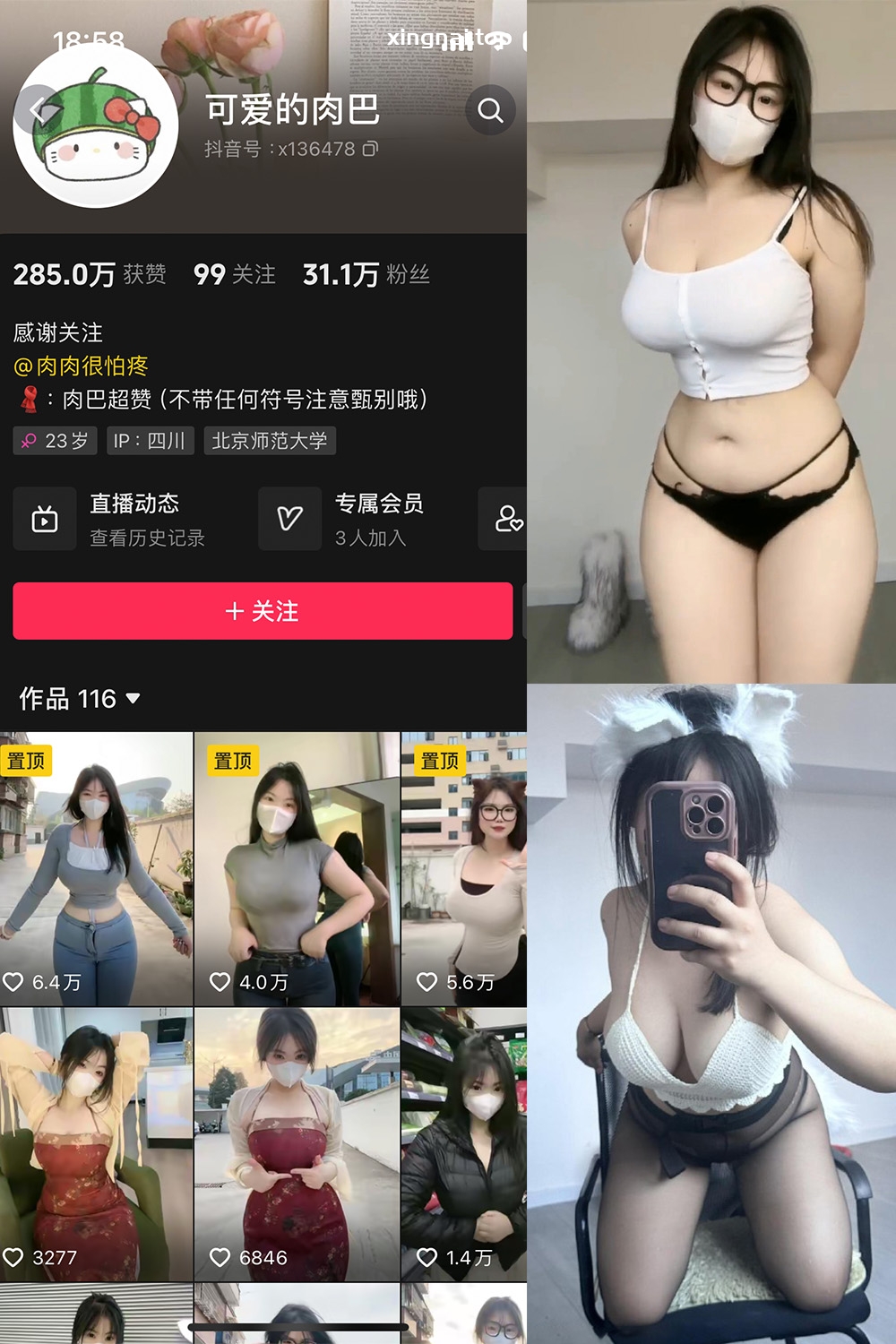 抖音 可爱的肉巴 微密圈  NO.014期 【19P12V】最新至：2024.3.7