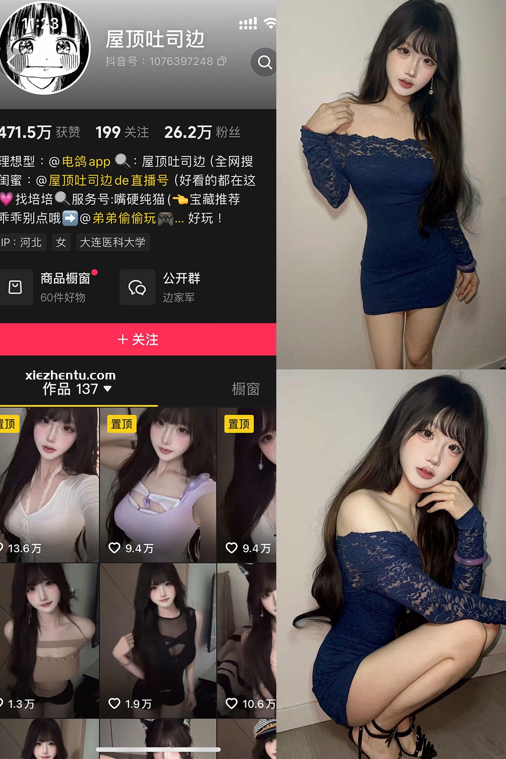 抖音 屋顶吐司边 岛遇 NO.001期 【10P11V】最新至：2025.7.4