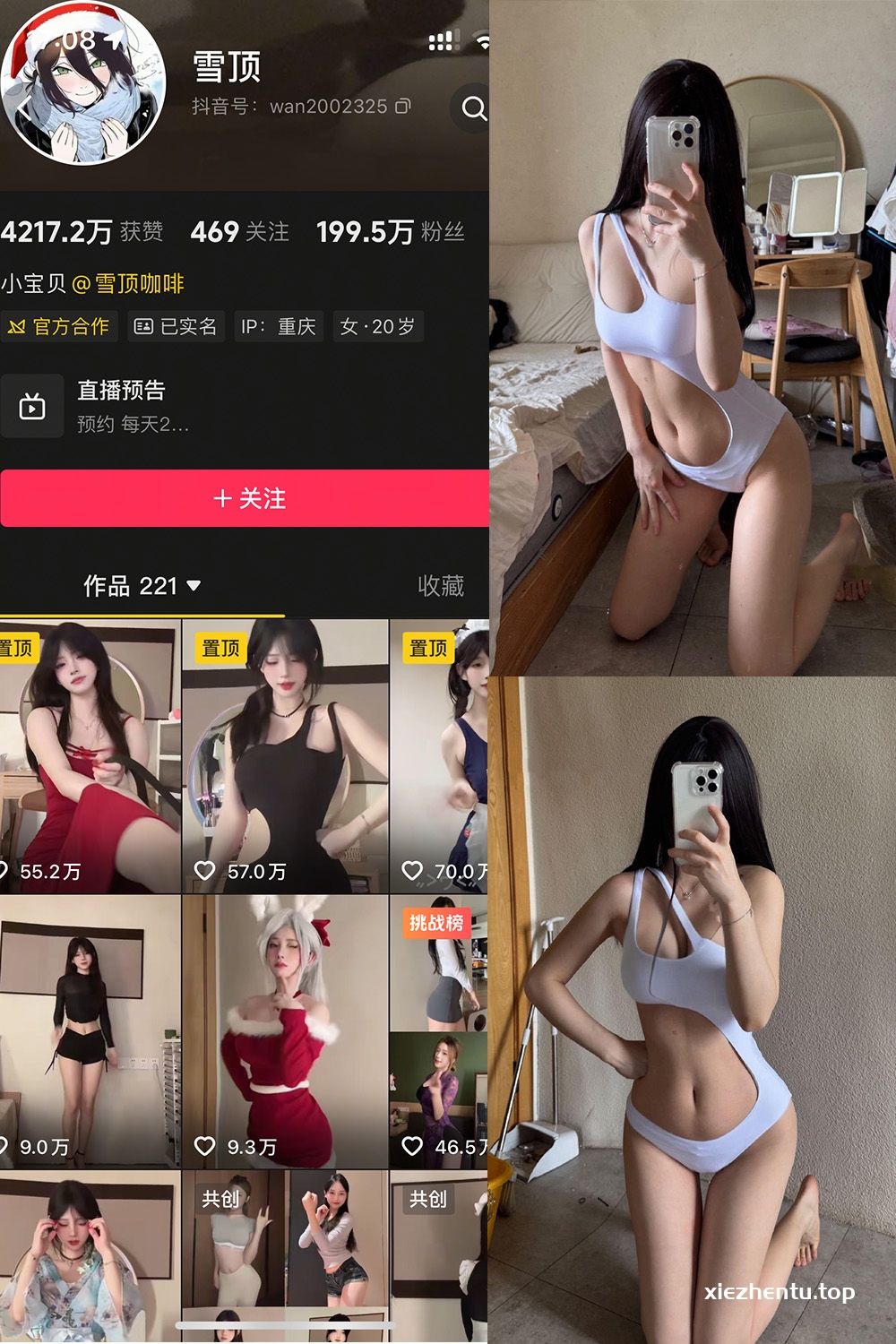 抖音 雪顶 岛遇 NO.014期 【25P】